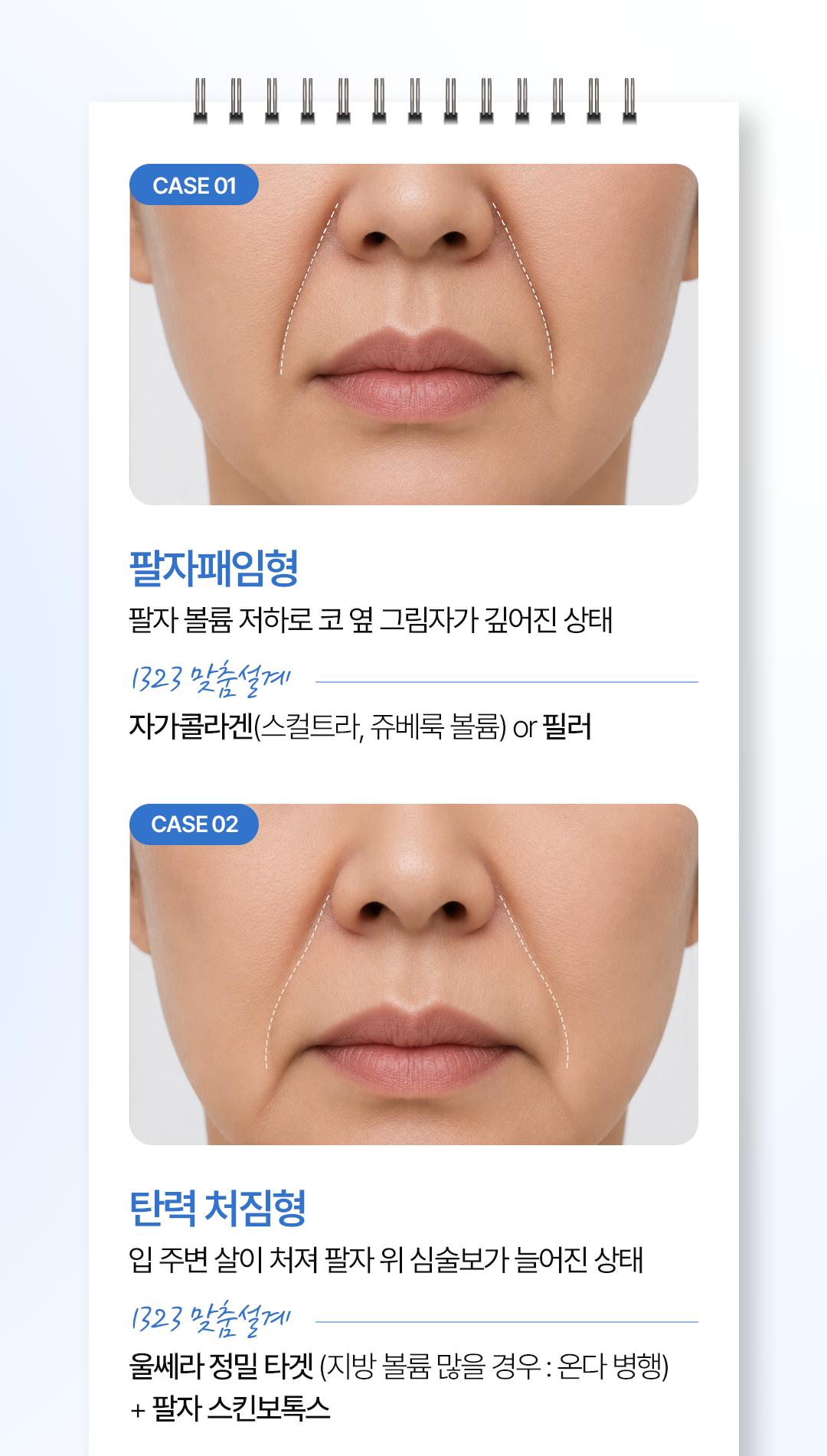 0731_1323의원홈페이지_팔자주름_08_01