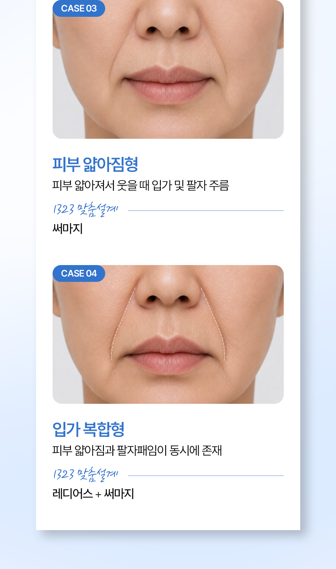 0731_1323의원홈페이지_팔자주름_08_02